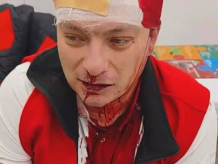 Опитът за убийство на Станислав Жулев е потулен срещу 2000 евро